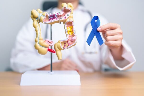 Study: Healthy Eating and Active Lifestyle after Bowel Cancer (HEAL ABC)—feasibility randomised controlled trial. Image Credit: Jo Panuwat D/Shutterstock.com