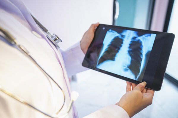 Cancer rates are rising in people under 50. Here’s what to do about it. • Kansas Reflector Cancer rates are rising in people under 50. Here's what to do about it. • Kansas Reflector
