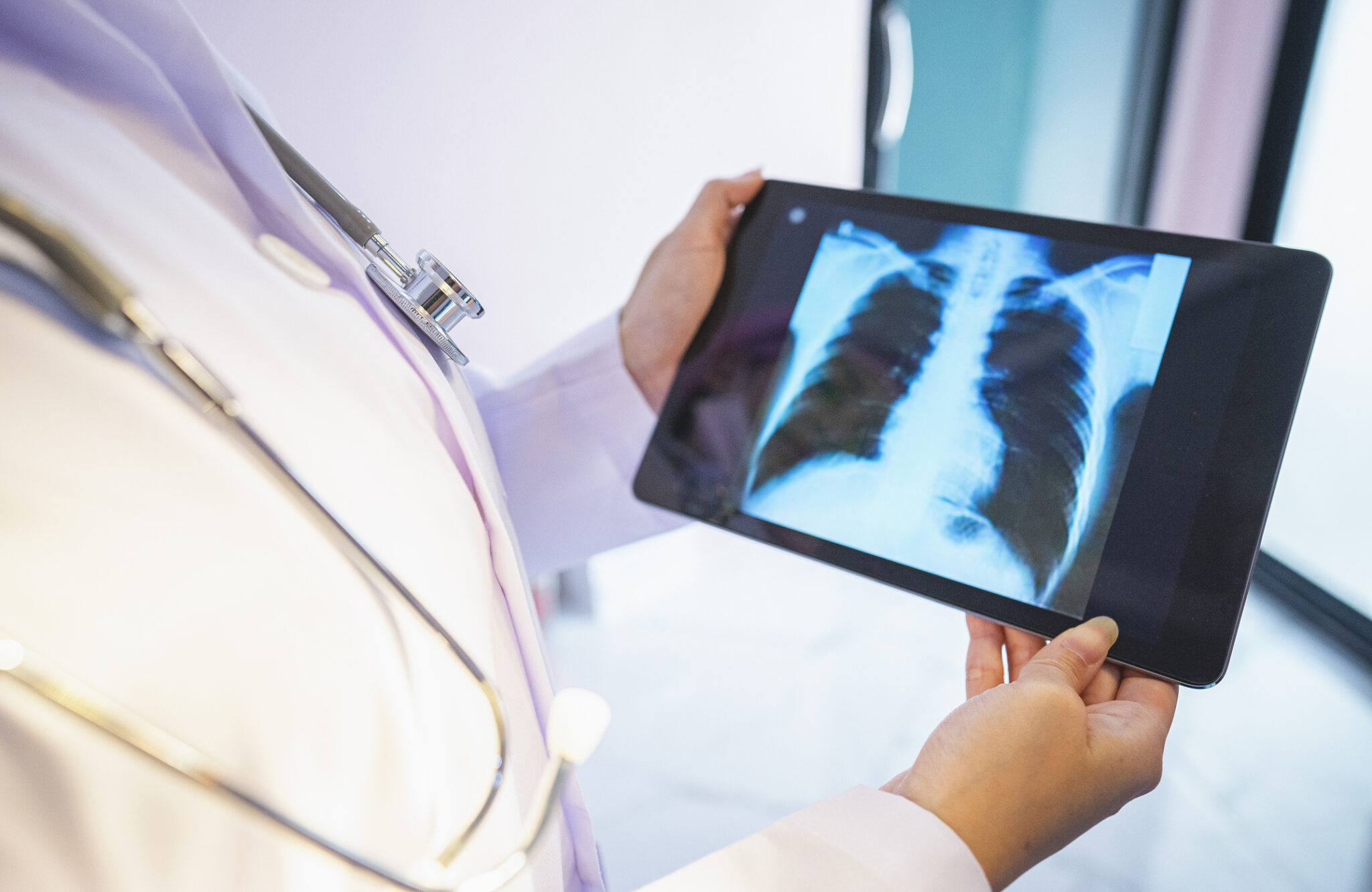 Cancer rates are rising in people under 50. Here's what to do about it. • Kansas Reflector