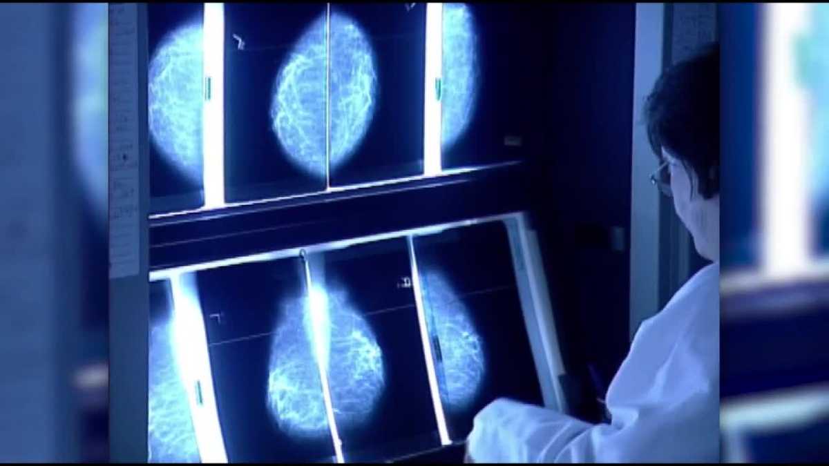 Healthy Living: Functional medicine and cancer