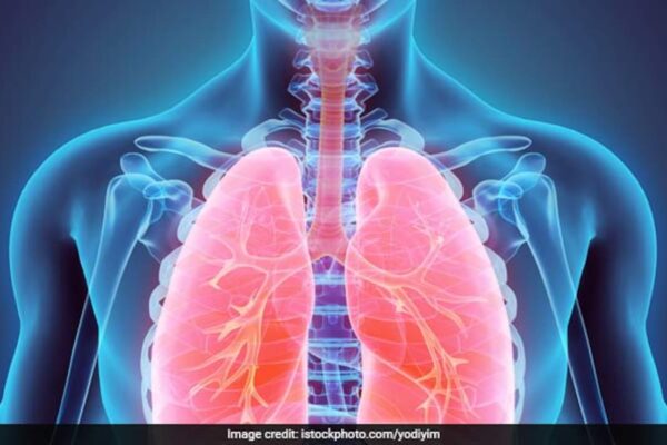 World COPD Day 2024: These Lifestyle Changes Can Improve Your Lung Health