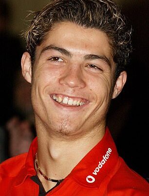 The internet has erupted into a heated debate over which male stars have had plastic surgery. Cristiano Ronaldo is seen in 2003