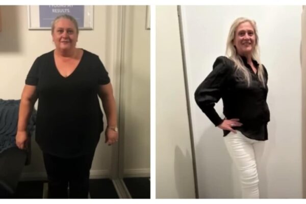 'Slimmer of the year' grandmother loses 52 kgs with a diet change: Here's how she did it | Health