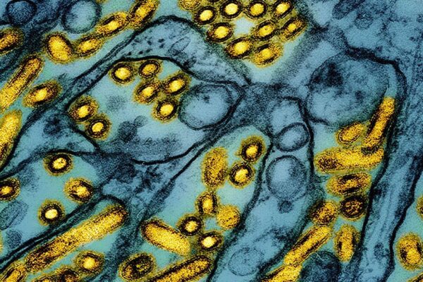 This colorized electron microscope image released by the National Institute of Allergy and Infectious Diseases on March 26, 2024, shows avian influenza A H5N1 virus particles (yellow), grown in Madin-Darby Canine Kidney (MDCK) epithelial cells (blue). (CDC/NIAID via AP, File)