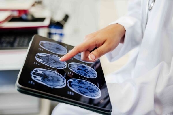 Study Links These Factors to a Younger-Looking Brain Study Links These Factors to a Younger-Looking Brain