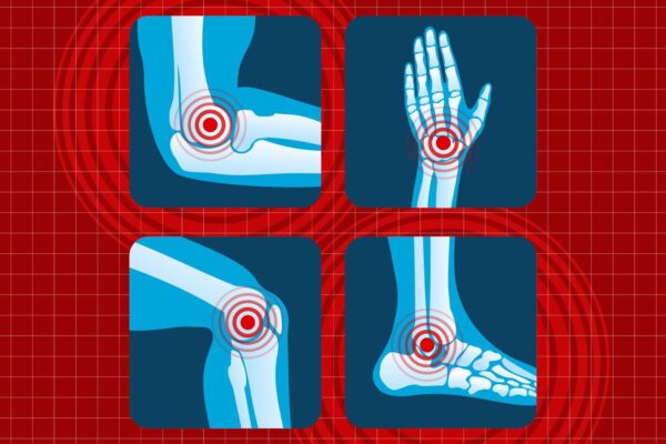 5 Common Arthritis Myths, Debunked by Science 5 Common Arthritis Myths, Debunked by Science