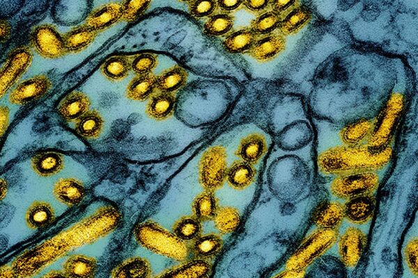 How are H5N9 and H5N1 different? What to know after California bird flu outbreak