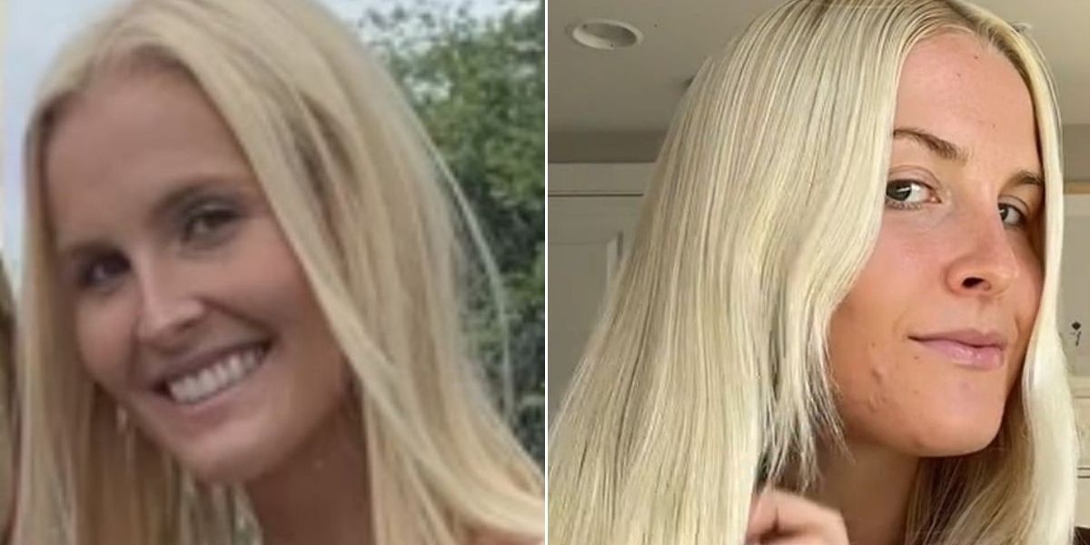 'I totally transformed the thickness and length of my hair by adding a nutrient powerhouse to my diet'