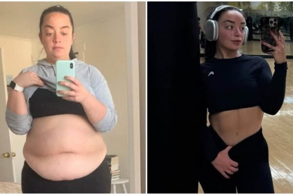 Woman who went from 136 kg to 73 kg and lost 64 kg shares the harsh truth about weight loss: ‘You will never look like…’ | Health