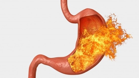Diet, lifestyle hacks to say goodbye to acid reflux and protect yourself from oesophageal cancer | Health Acid reflux management guide: Causes, symptoms, effective treatment options and prevention tips to avoid esophageal cancer.(Image by Freepik)