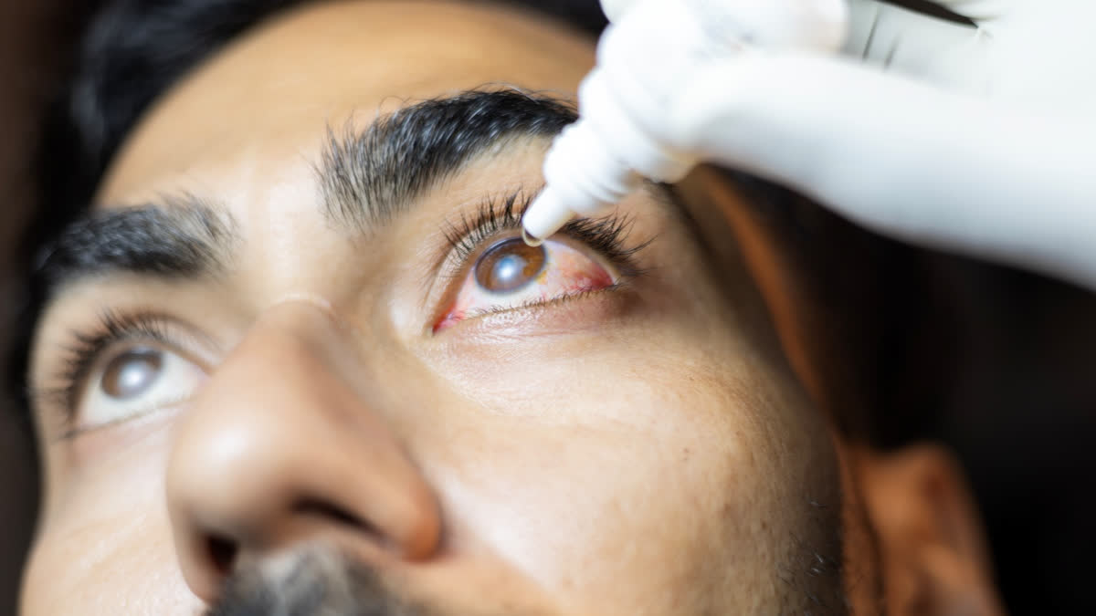 Glaucoma is often associated with increased eye pressure (Representational Image)