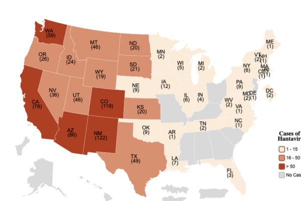 What to know about hantavirus pulmonary syndrome