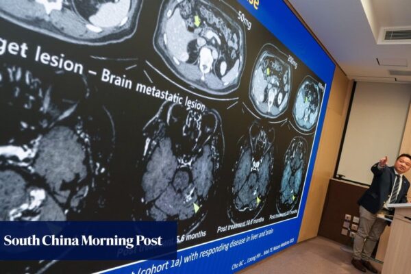 Mainland Chinese drug effective in treating 3 cancer types: Hong Kong-led study