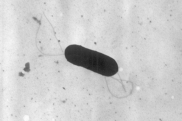 At least 10 people sickened in US listeria outbreak linked to prepared foods At least 10 people sickened in US listeria outbreak linked to prepared foods