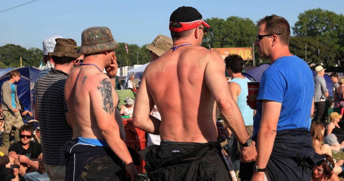 Minister criticises UK’s ‘obsession’ with ‘laughing’ about sunburn