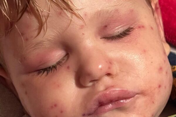 Boy, 2, fighting for his life after being stung by wasps 150 times | News US