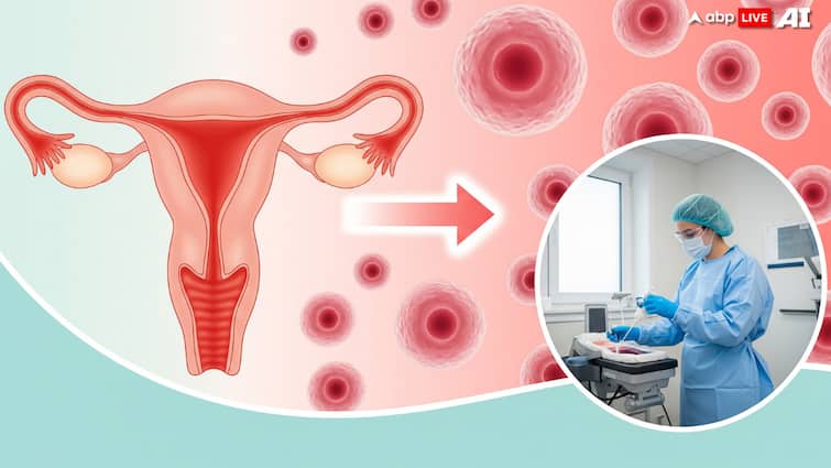 Cervical Cancer: Not Just HPV, Here’s How Lifestyle, Immunity and Inequity Play a Role Cervical Cancer: Not Just HPV, Here’s How Lifestyle, Immunity and Inequity Play a Role