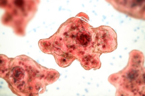 Texas woman dies from brain-eating amoeba after using tap water for sinus rinse Texas woman dies from brain-eating amoeba after using tap water for sinus rinse