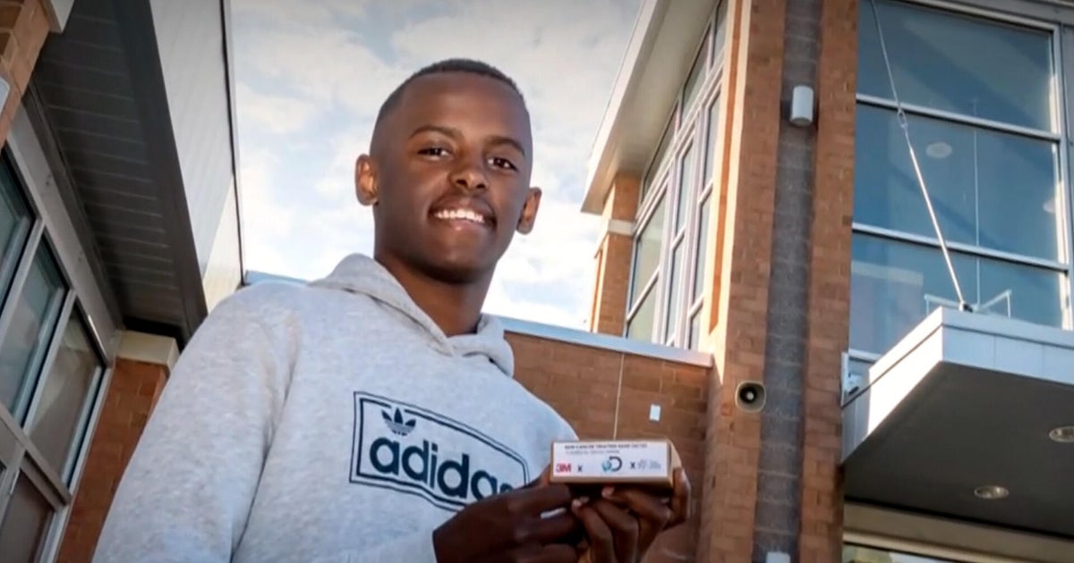 Teenager wants to cure skin cancer with soap