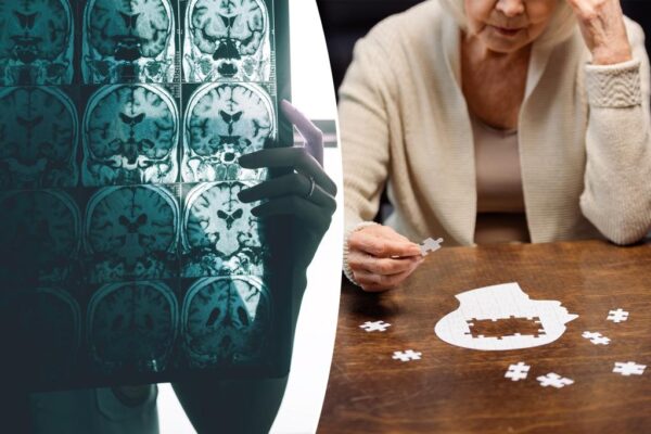11 lifestyle changes to ward off Alzheimer's disease
