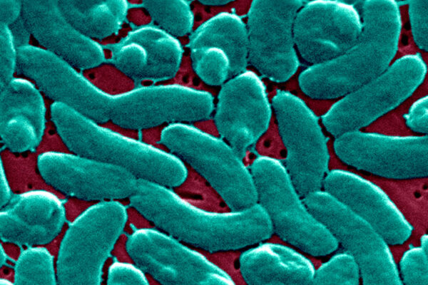 Here's who's at-risk after four die from flesh-eating bacteria in Florida