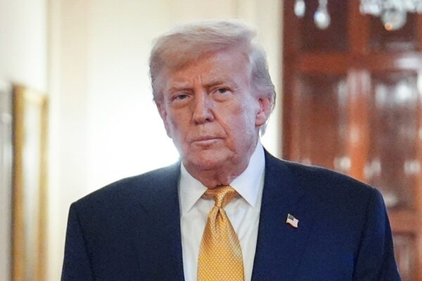 What is chronic venous insufficiency, Trump's diagnosis?