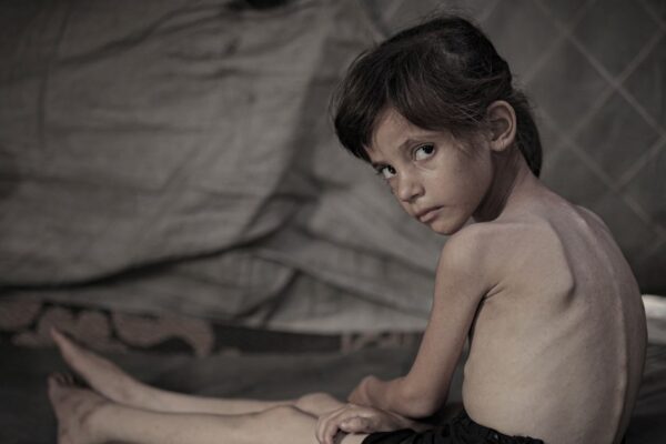 Gaza hunger reaches 'tipping point' as children suffer malnutrition