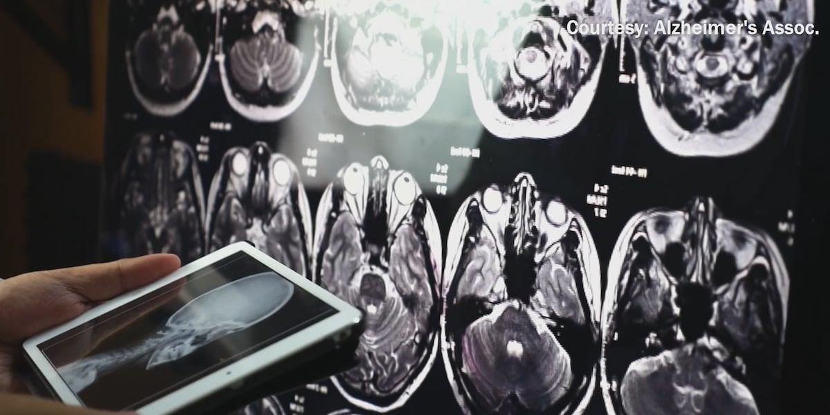 Small lifestyle adjustments can significantly impact brain health