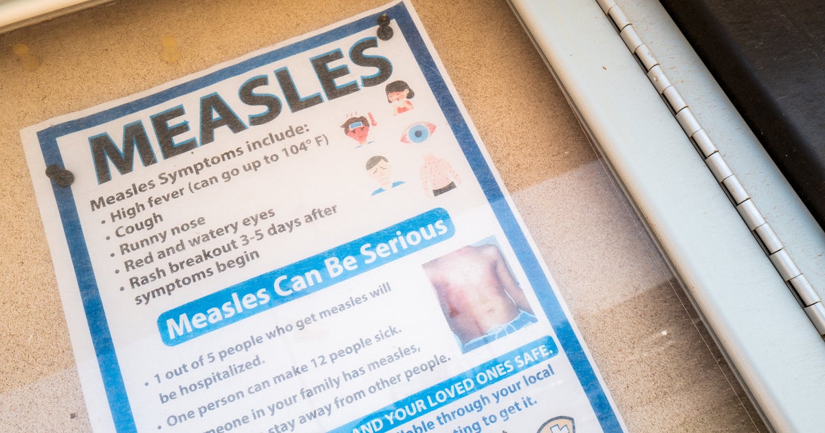 Measles Outbreak Hits Another State