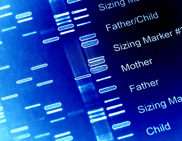 Healthy lifestyle lowers risk of diverticulitis despite genetic susceptibility