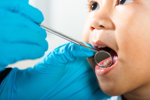 Even healthy eating can’t guarantee cavity-free kids, study reports Study: Early-life snack and drink consumption patterns among children: findings from a U.S. birth cohort study. Image Credit: Sorapop Udomsri / Shutterstock