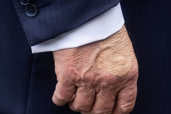 White House Tries to Shake Off Trump’s Bizarre Hand Make-Up