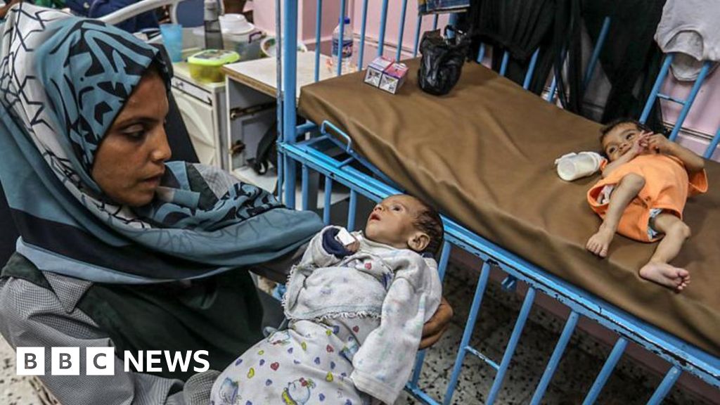 One in five children in Gaza is malnourished, UN aid agency says