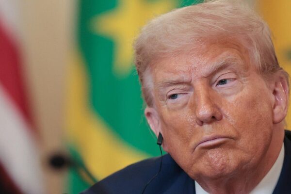 Medical expert on Trump’s chronic venous insufficiency diagnosis Medical expert on Trump's chronic venous insufficiency diagnosis