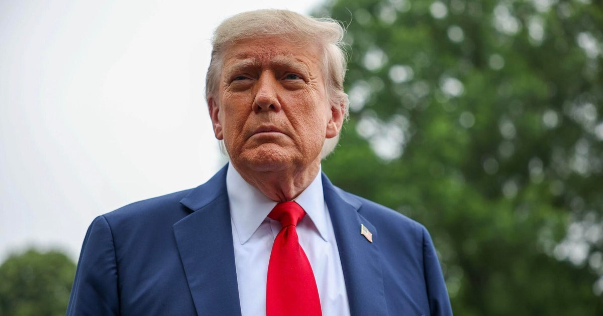 Trump diagnosed with chronic venous insufficiency, a minor vein condition, after noticing swelling in legs