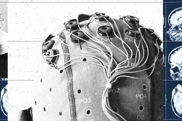 China Is Building a Brain-Computer Interface Industry