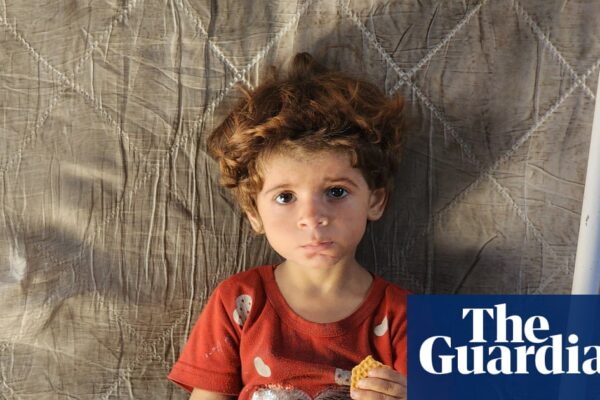 ‘Very sick and very tired’: the reality of famine for Gaza’s most vulnerable | Israel-Gaza war