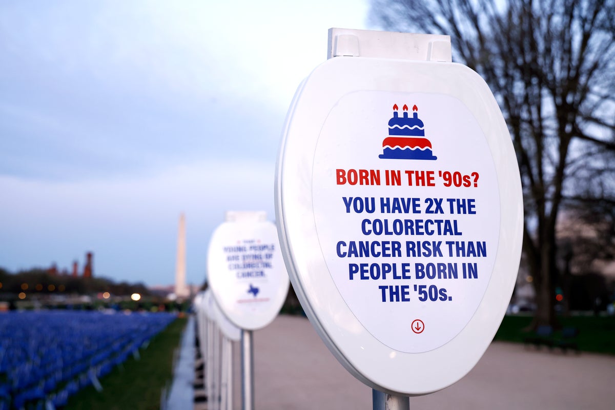 Major increase in colorectal cancer in younger adults tied to pandemic years, researchers say