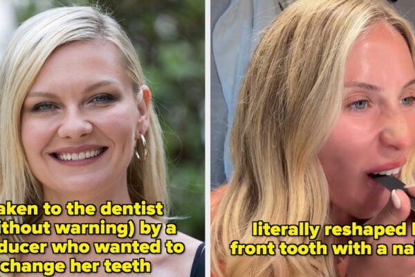 Celebrities Who Refused To Fix Their Teeth Or Regretted Dental Work