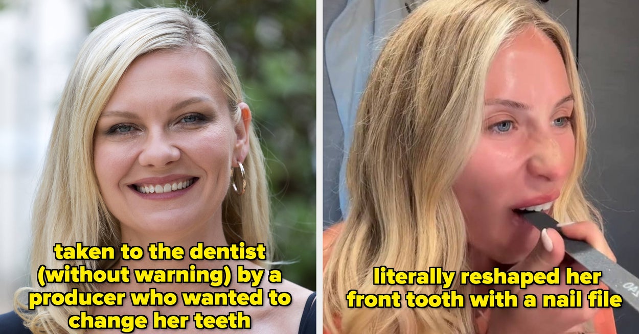 Celebrities Who Refused To Fix Their Teeth Or Regretted Dental Work