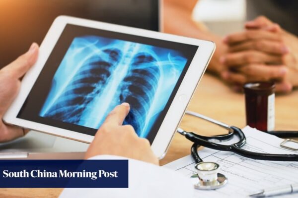 Hongkongers with lung cancer risk urged to get tested after actor Will Or’s diagnosis