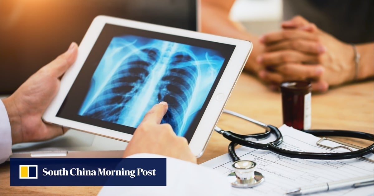 Hongkongers with lung cancer risk urged to get tested after actor Will Or’s diagnosis