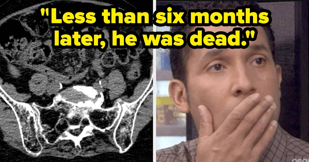 Doctors Share “Mild” Symptoms That Actually Can Be Something Major