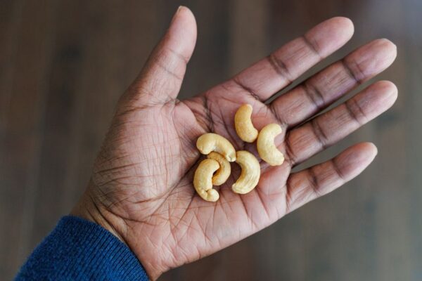 Are Cashews Good for You? We Asked Dietitians