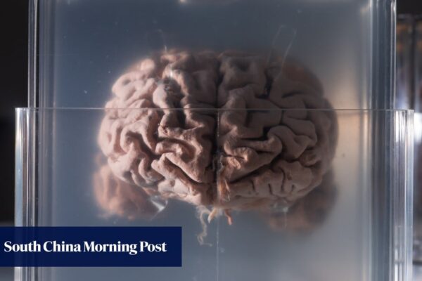 Can China’s new tech crack Einstein’s brain? Scientists hope to give it a try