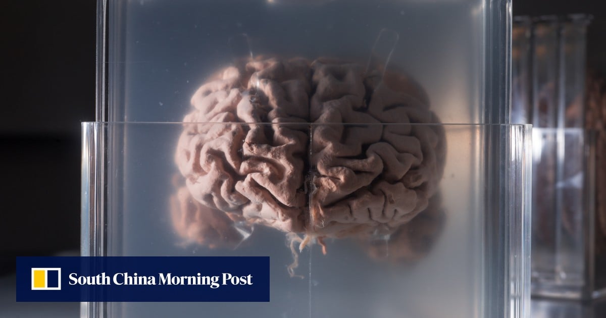 Can China’s new tech crack Einstein’s brain? Scientists hope to give it a try
