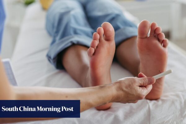 Hong Kong scientists developing new blood flow treatment to aid diabetes patients Hong Kong scientists developing new blood flow treatment to aid diabetes patients
