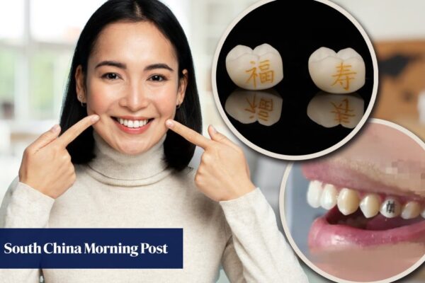 China youth engrave motivational phrases like ‘get rich’ on dental caps, raises concerns China youth engrave motivational phrases like ‘get rich’ on dental caps, raises concerns