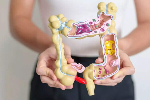 How your morning breakfast could protect you from colon cancer |