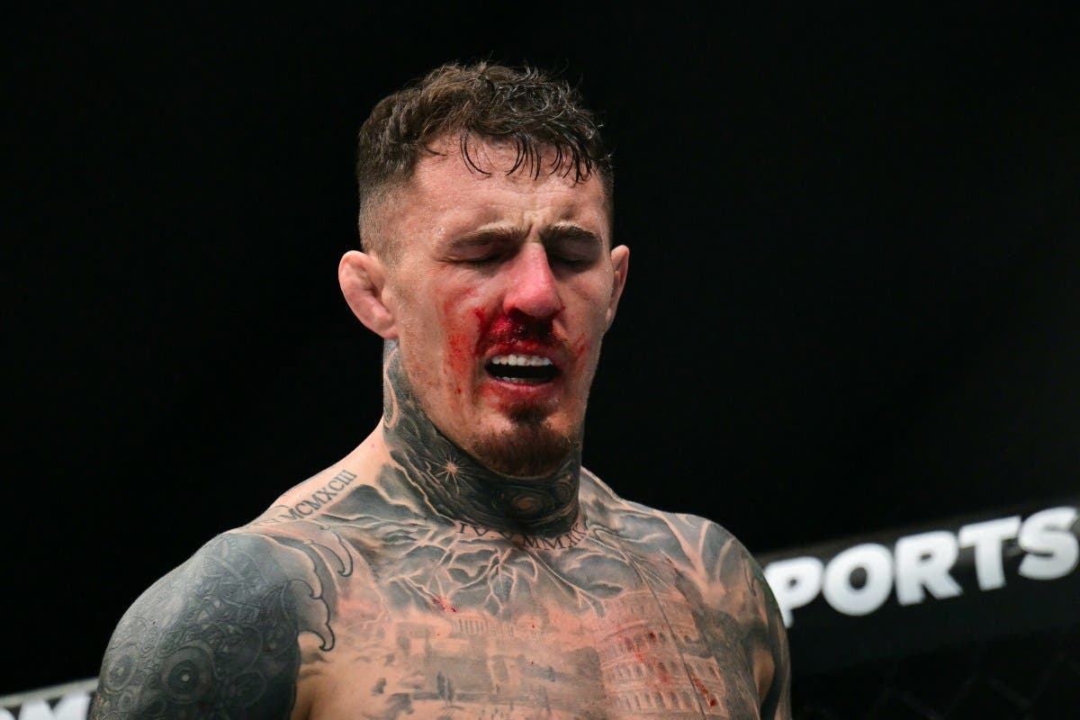 Britain's Tom Aspinall reacts after being hit in the eye while fighting France's Ciryl Gane during their UFC heavyweight title bout at UFC 321 at Etihad Arena in Abu Dhabi early on October 26, 2025.
